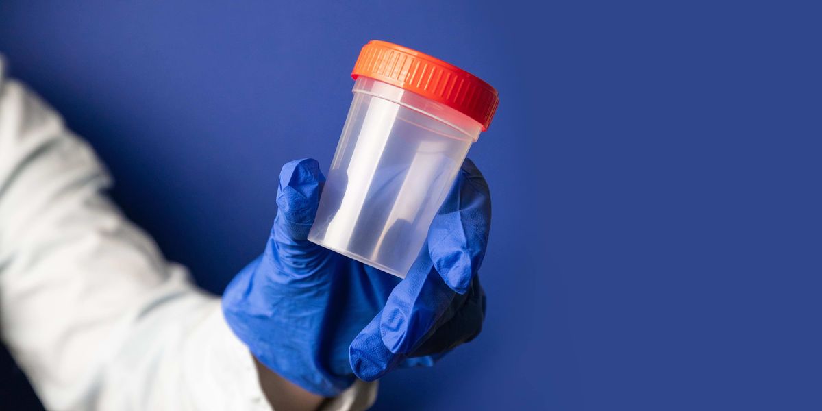 Can Certo Help You to Beat a Drug Test The Bluntness Can Certo Help You to Beat a Drug Test The Bluntness