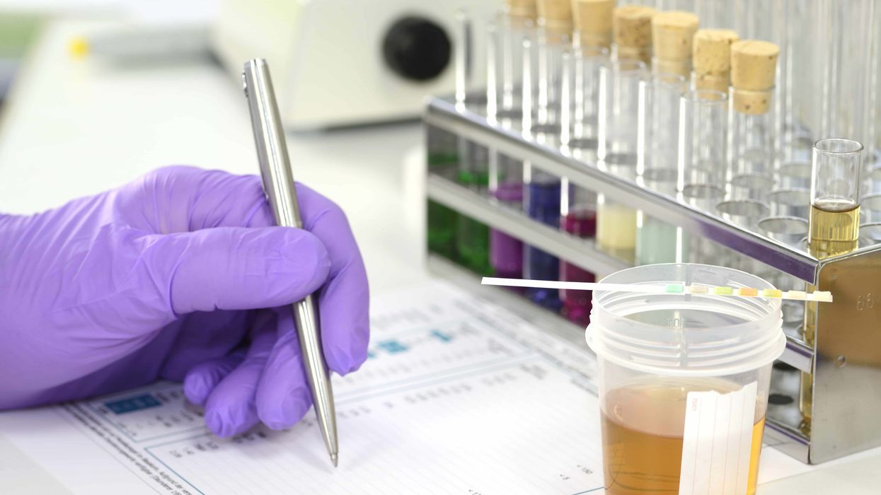 Drug testing companies have a vested interest in cannabis prohibition.