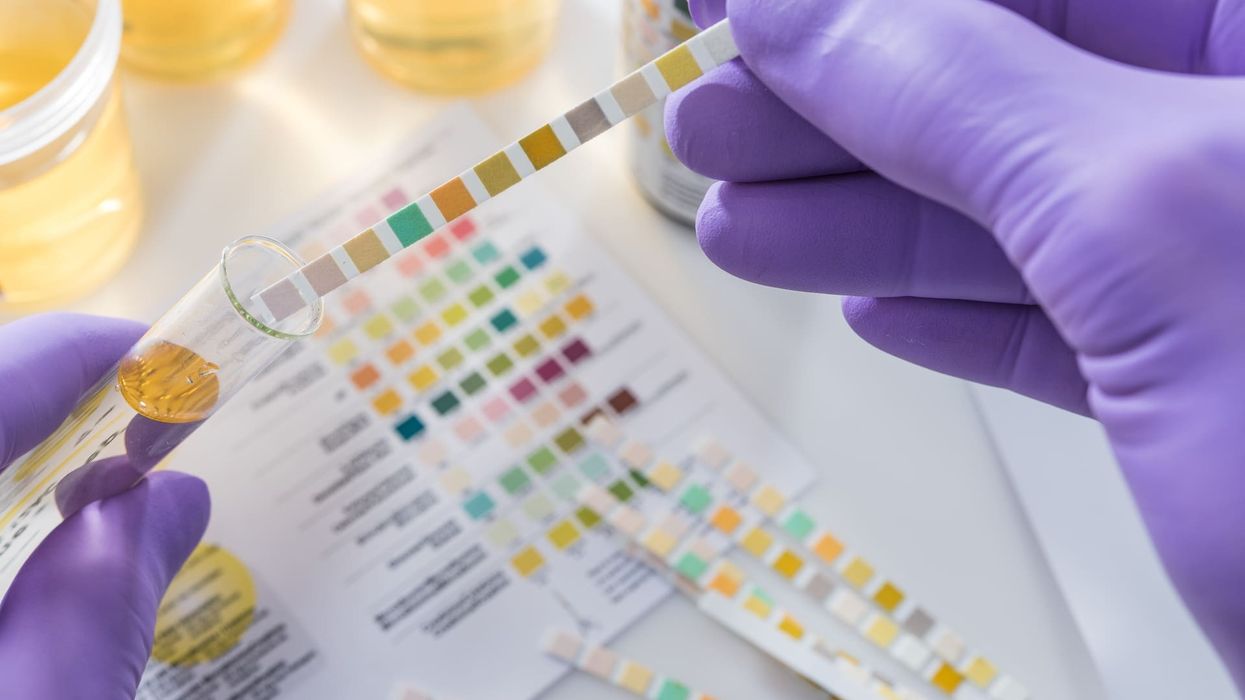 Delta-8 Drug Test Informational Guide