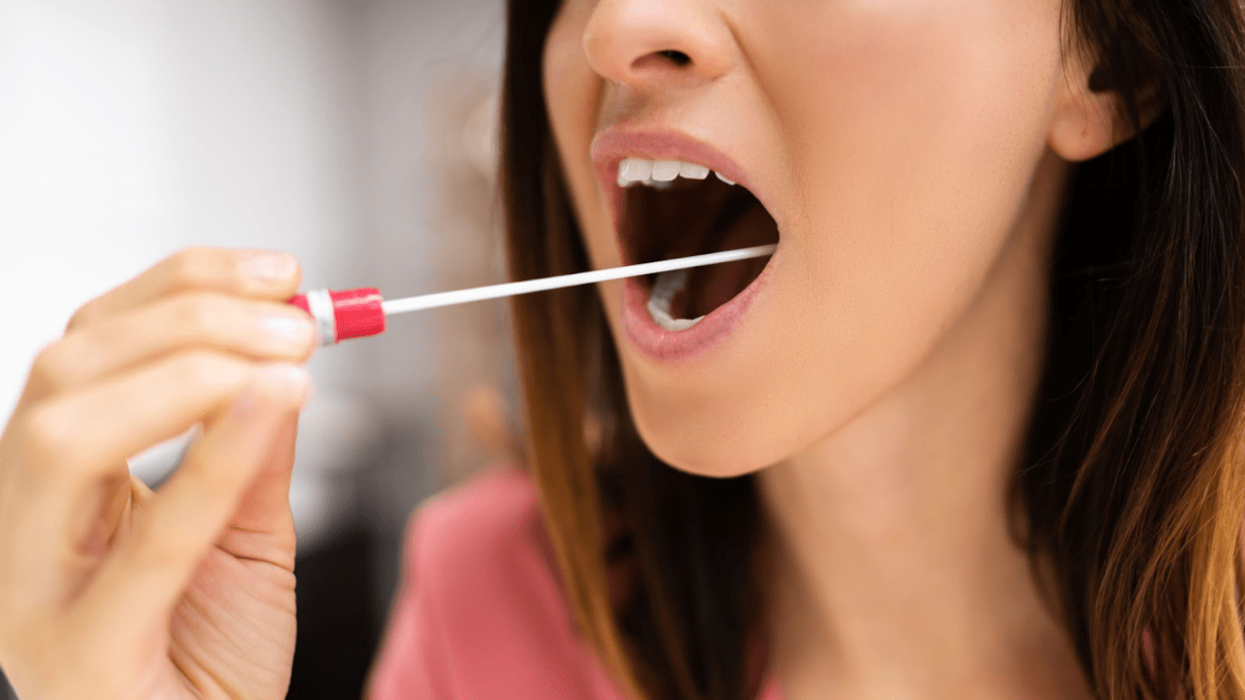 How to Pass a Saliva Drug Test