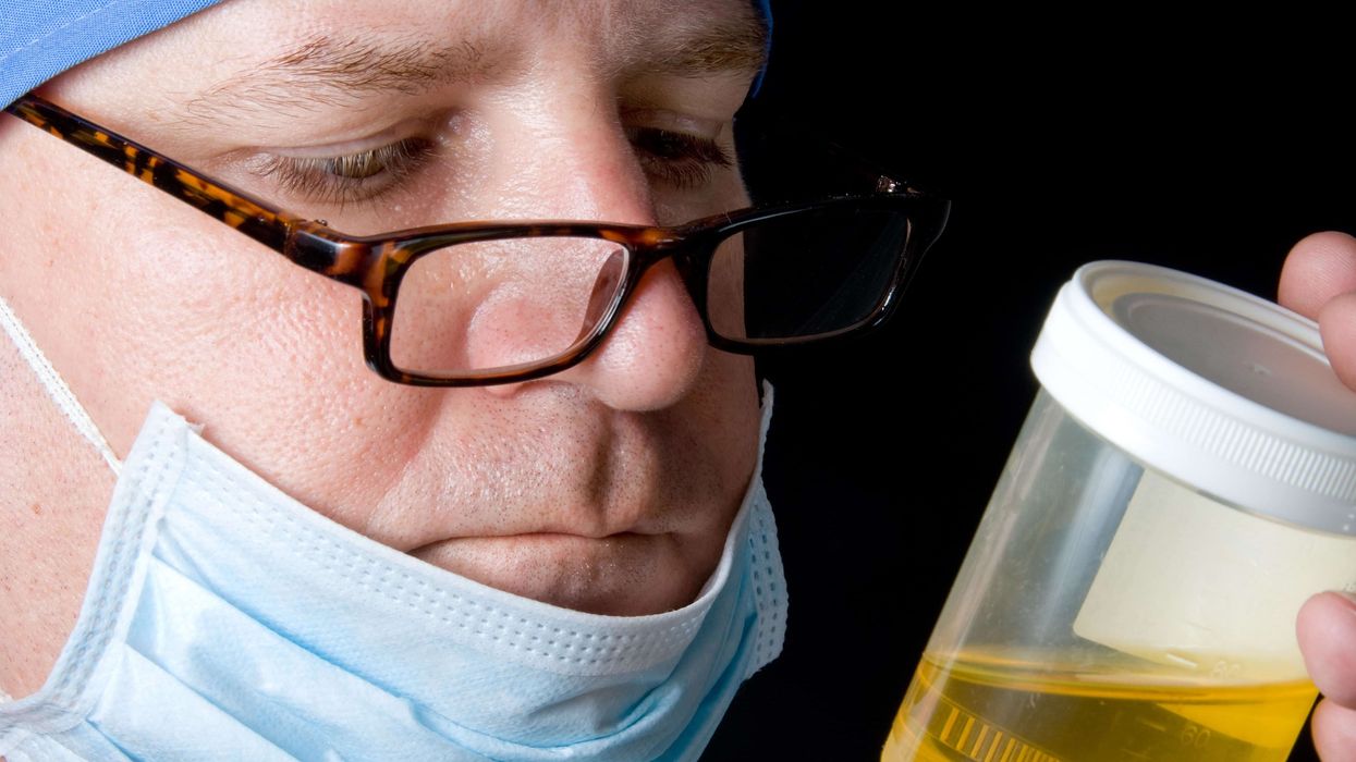 Synthetic urine to pass a drug test? Maybe not the best idea.